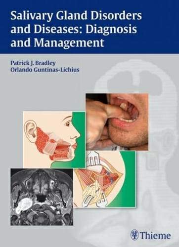 salivary-gland-disorders-and-diseases-diagnosis-and-management-1e