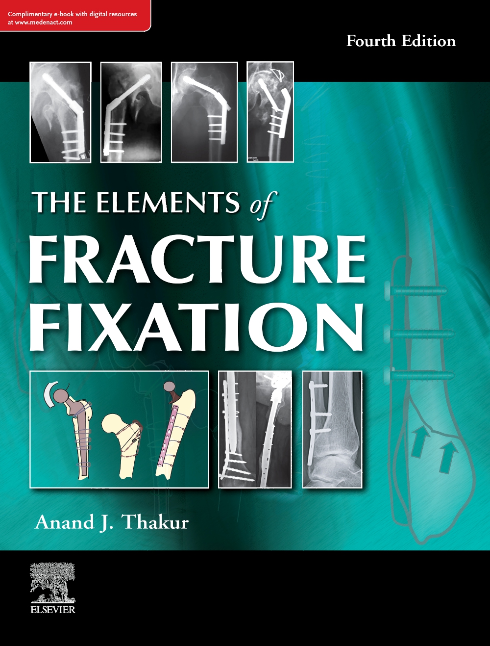 the-elements-of-fracture-fixation-4e