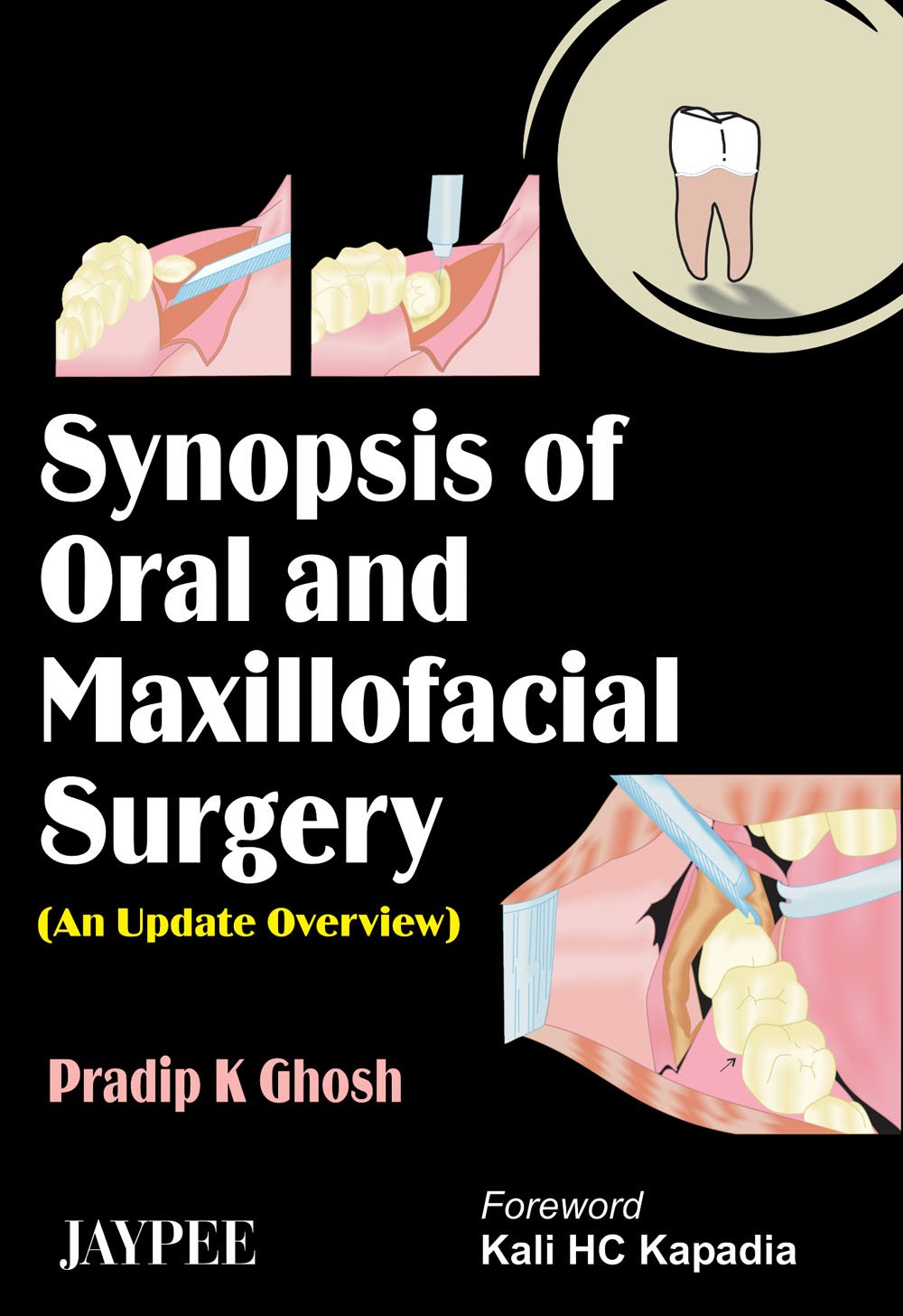 synopsis-of-oral-and-maxillofacial-surgery-an-update-overview