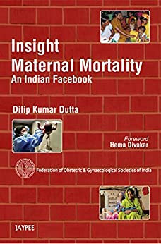 insight-maternal-mortality-an-indian-facebookfederation-of-obsgyn-societies-of-india