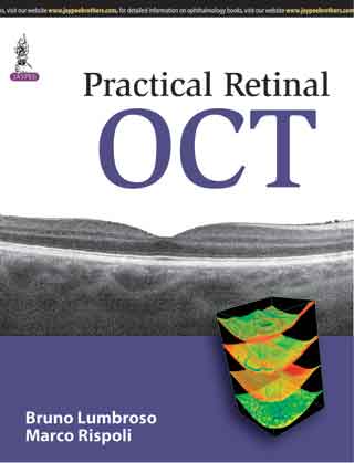 practical-retinal-oct