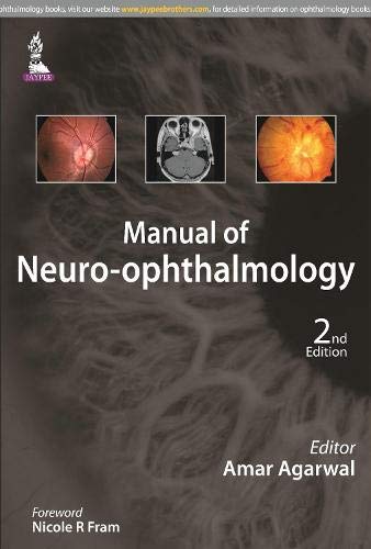 manual-of-neuro-ophthalmology