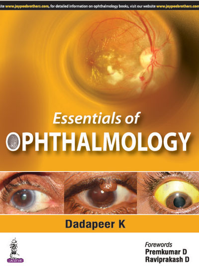 essentials-of-ophthalmology