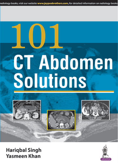 101-ct-abdomen-solutions