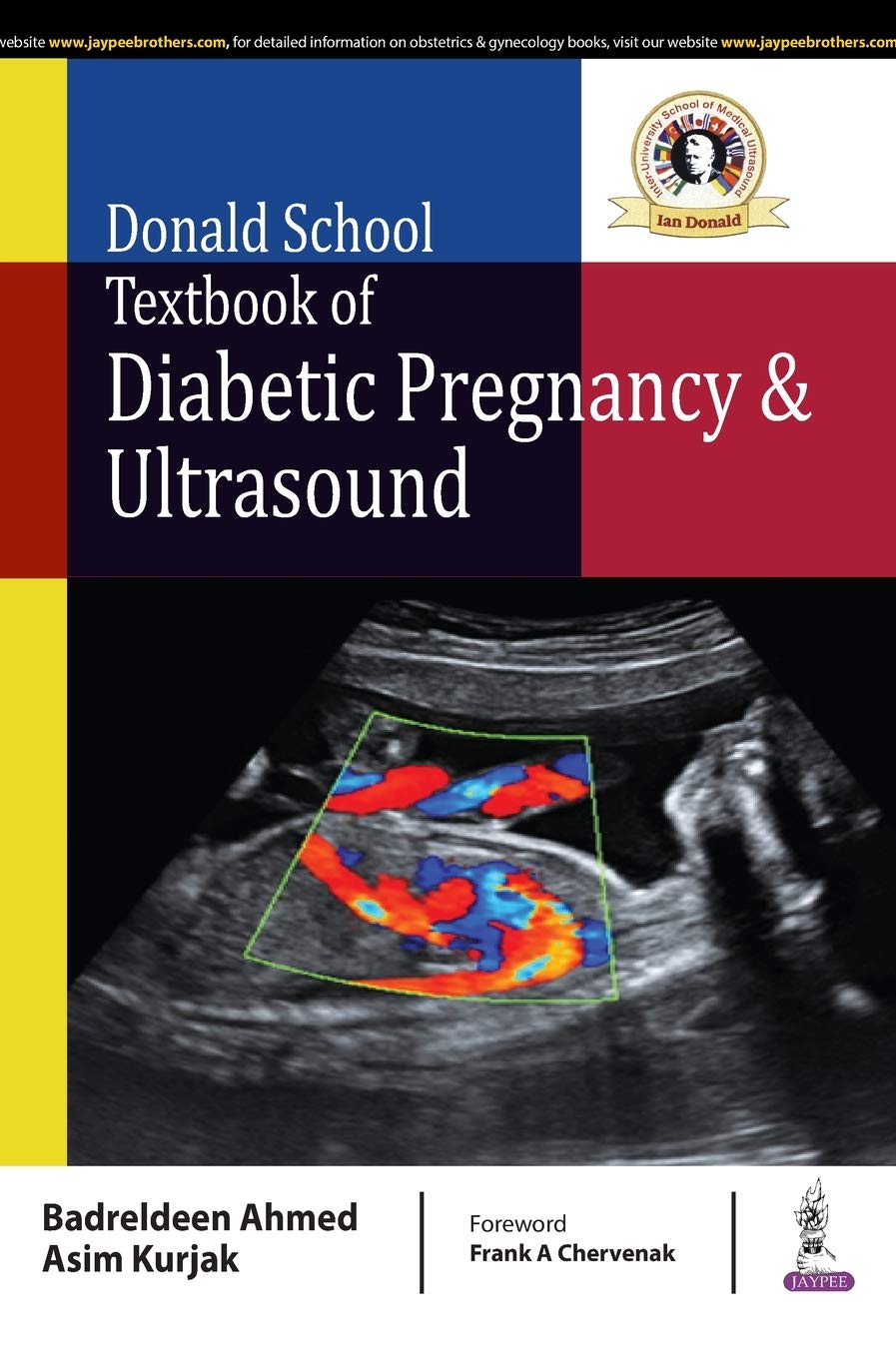 Diabetes in pregnancy.