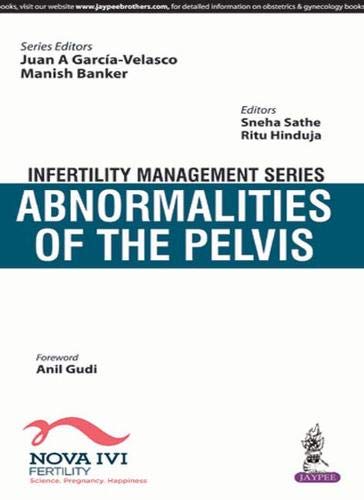 infertility-management-series-abnormalities-of-the-pelvis