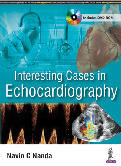 interesting-cases-in-echocardiography-includes-dvd-rom