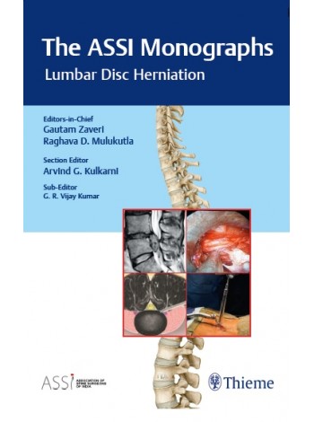 the-assi-monographs-lumbar-disc-herniation-1e