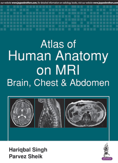 atlas-of-human-anatomy-on-mribrain-chest-abdomen