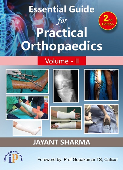 essential-guide-for-practical-orthopaedics-vol-2