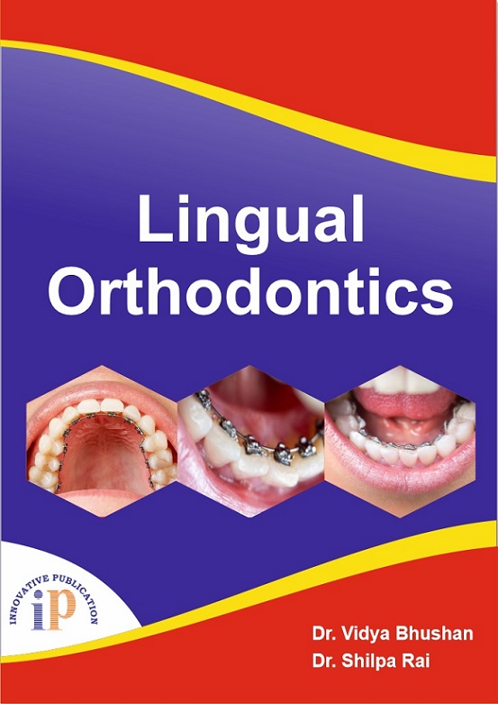 lingual-orthodontics