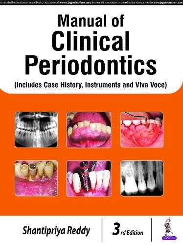 essentials-of-clinical-periodontology-and-periodontics-with-supplementary-manual-of-clinical-periodontics-with-interactive-dvd-rom