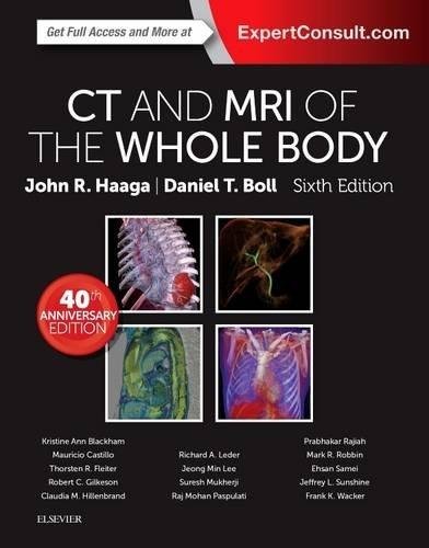 ct-and-mri-of-the-whole-body-2-volume-set-6e