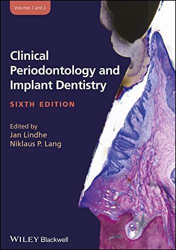 clinical-periodontology-and-implant-dentistry-6ed-2-vols-set-hb-2015-special-price