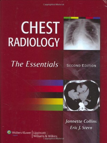 chest-radiology-the-essentials-2ed-old-edition