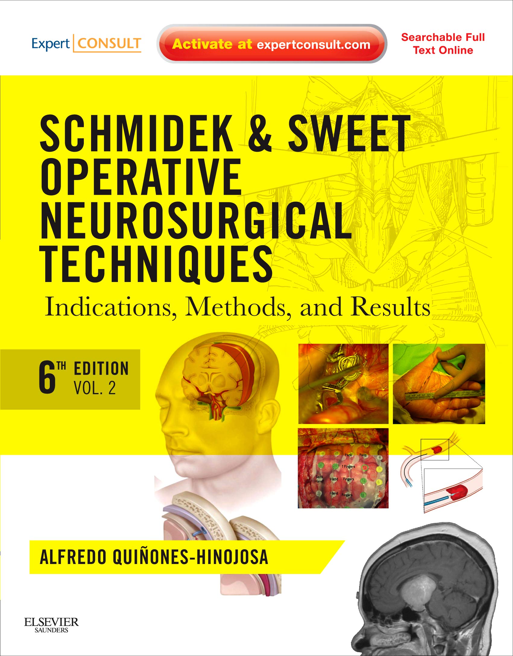 schmidek-and-sweet-operative-neurosurgical-techniques-2-volume-set-indications-methods-and-results-expert-consult-online-and-print-6e