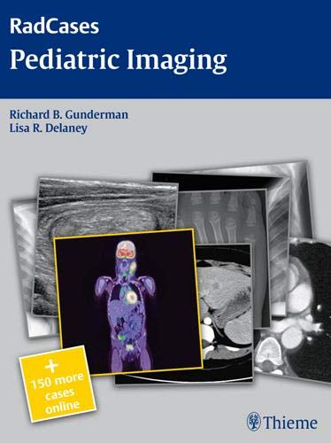 pediatric-imaging