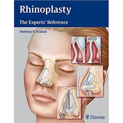 rhinoplasty-the-experts-reference-1e