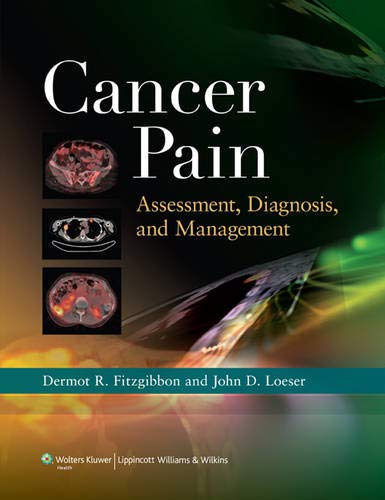 cancer-pain-assessment-diagnosis-and-management-old-edition