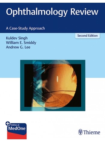 ophthalmology-review-a-case-study-approach-2e