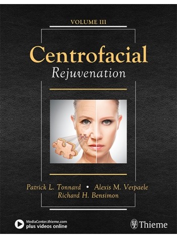 centrofacial-rejuvenation-1e