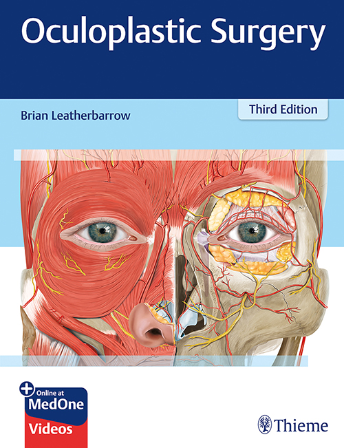 oculoplastic-surgery-3e