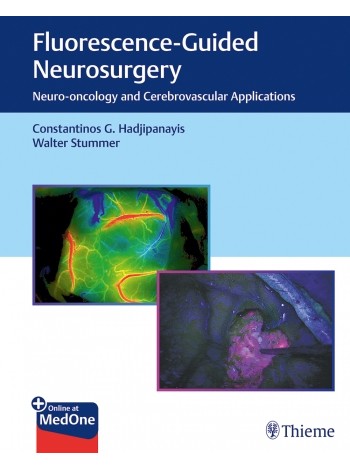 fluorescence-guided-neurosurgery-neuro-oncology-and-cerebrovascular-applications-1e