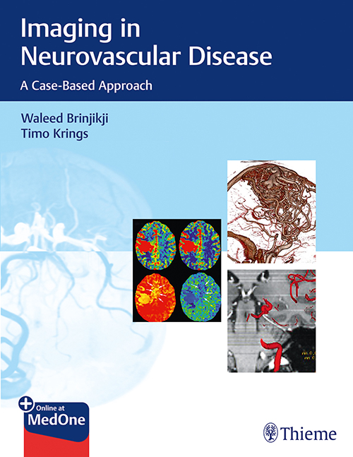 imaging-in-neurovascular-disease-1e