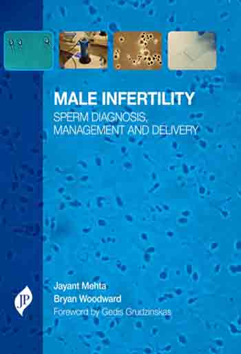 male-infertility-sperm-diagnosis-management-and-delivery