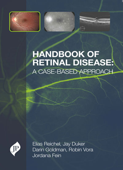 handbook-of-retinal-disease-a-case-based-approach