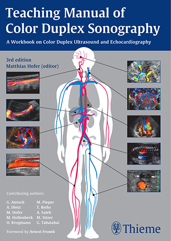 teaching-manual-of-color-duplex-sonography-3e