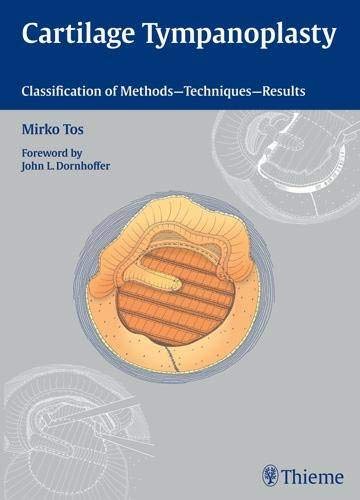 cartilage-tympanoplasty-classification-of-methods-techniques-results-1e