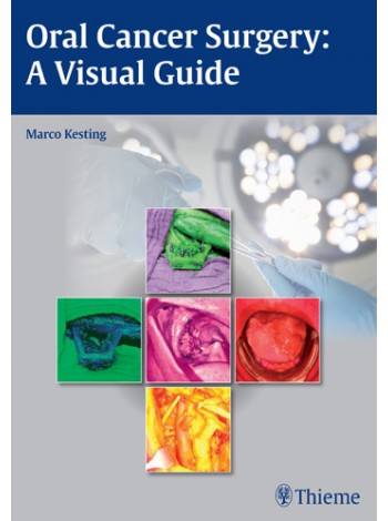 oral-cancer-surgery-a-visual-guide-1e