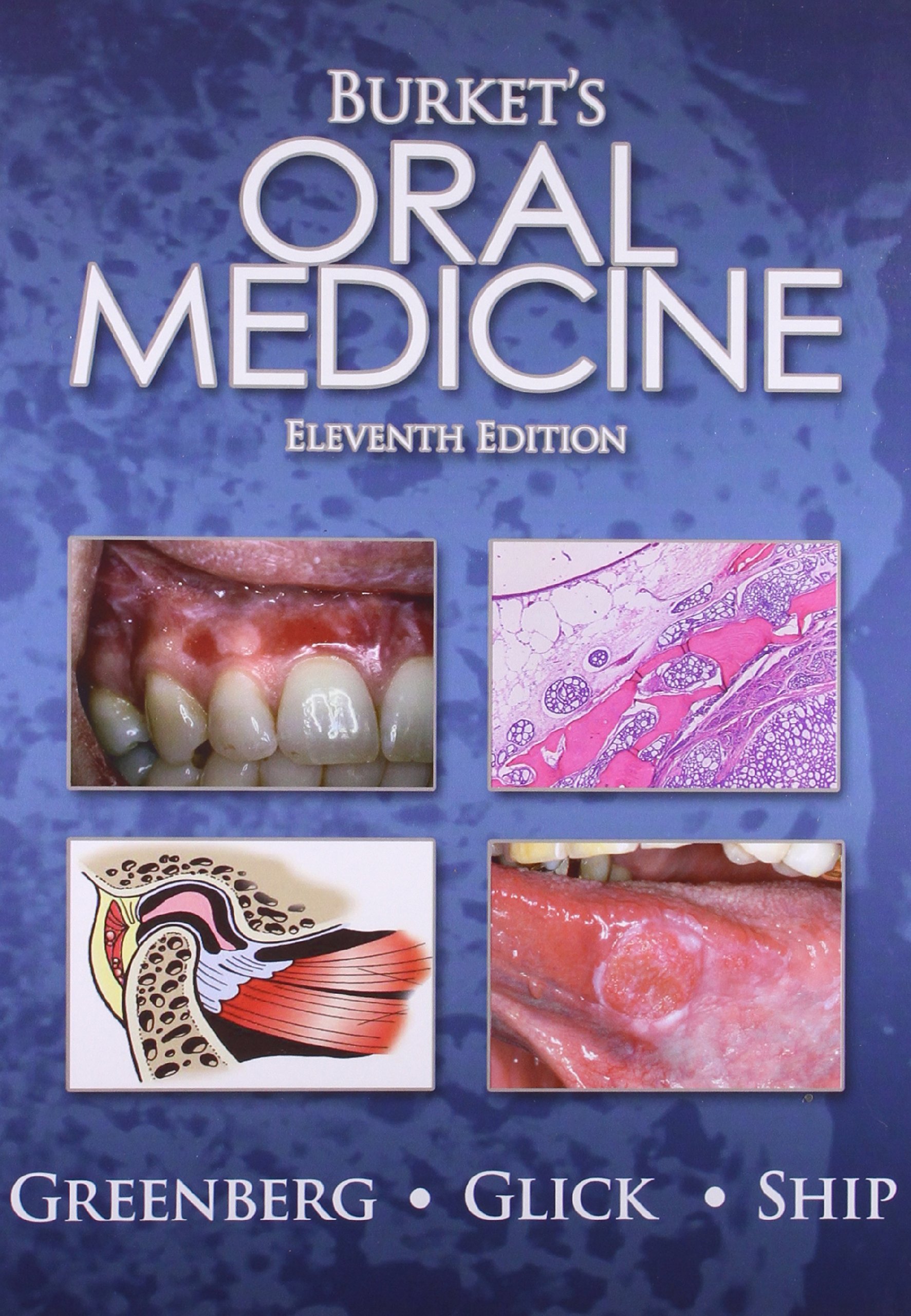 burkets-oral-medicine-11e