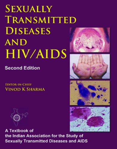 sexually-transmitted-diseases-and-hivaids