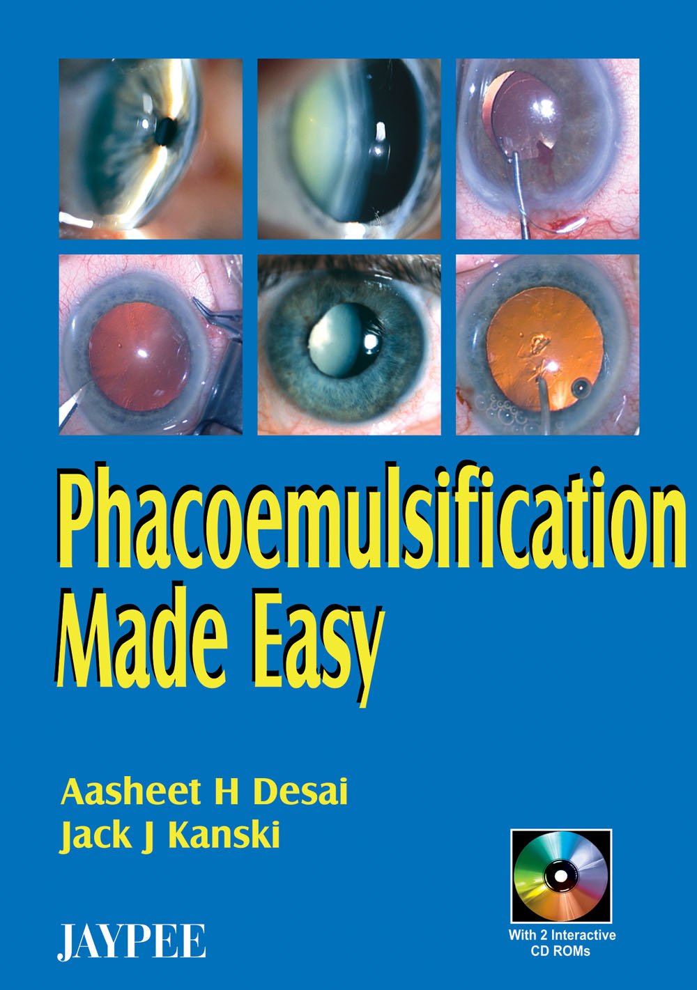 phacoemulsification-made-easy-with-2-intcd-roms