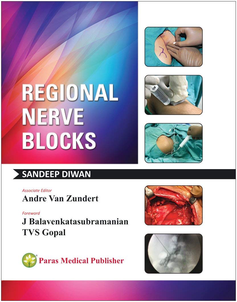 regional-nerve-blocks