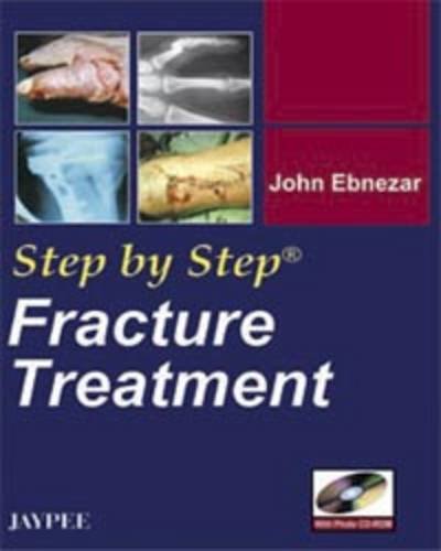 step-by-step-fracture-treatment-with-photo-cd-rom