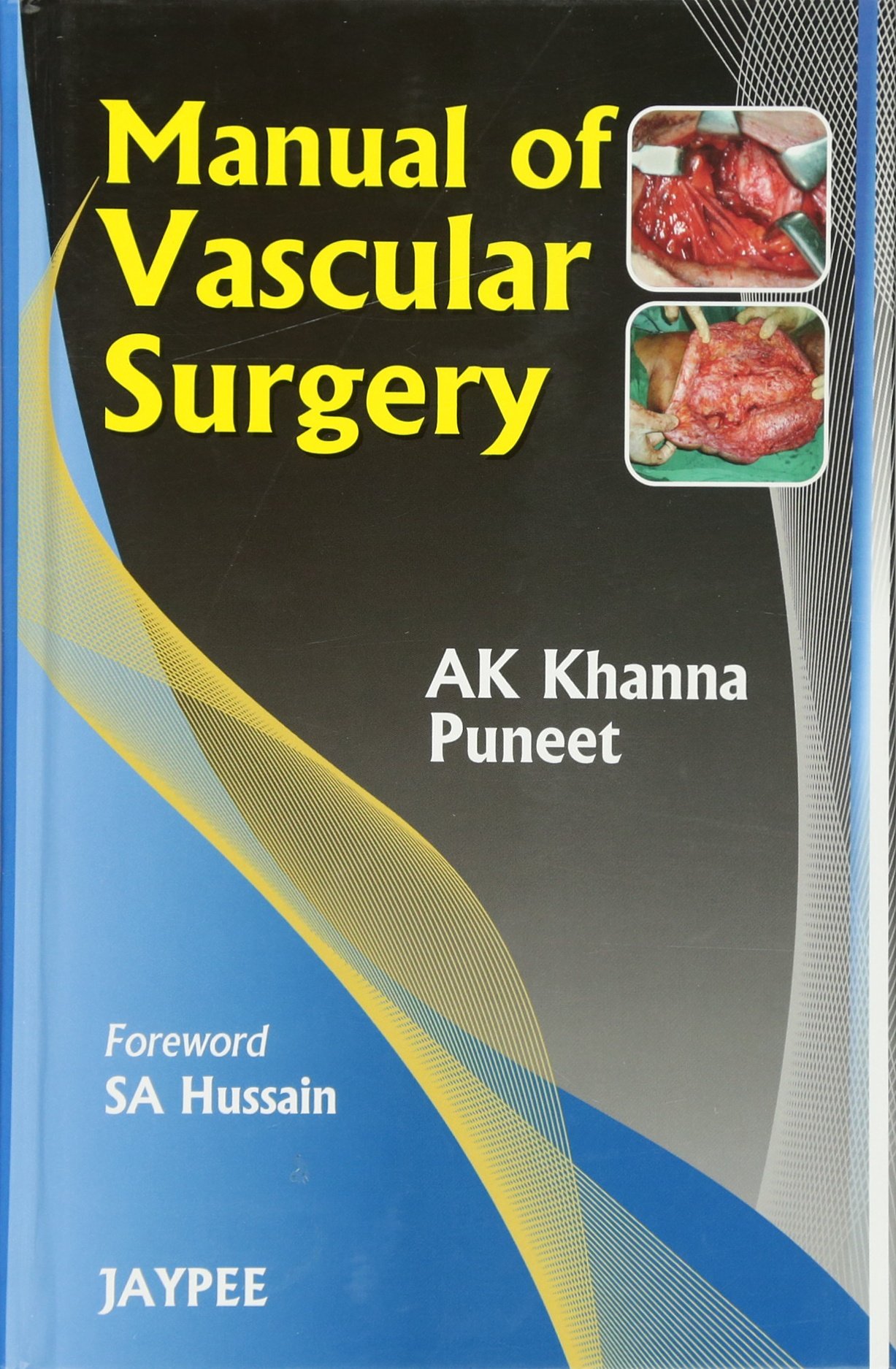 manual-of-vascular-surgery