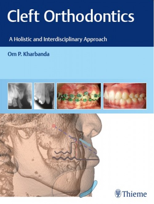 cleft-orthodontics