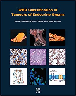 who-classification-of-tumours-of-endocrine-organs-4e-world-health-organization-who-classification-of-tumours