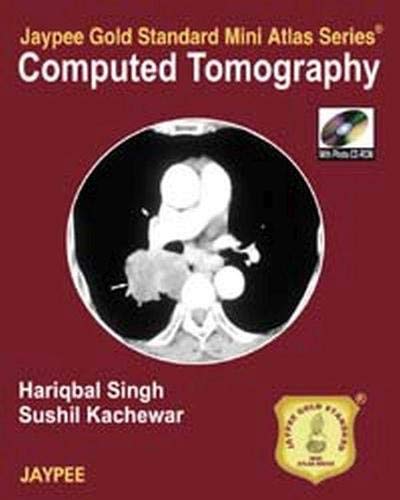 computed-tomography-jaypee-gold-standard-mini-atlas-series-with-photo-cd-rom