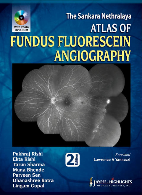 the-sankara-nethralaya-atlas-of-fundus-fluorescein-angiography