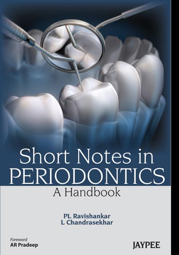 short-notes-in-periodontics-a-handbook