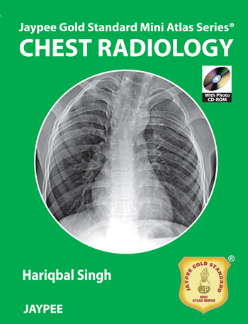 jaypee-gold-standard-mini-atlas-series-chest-radiology-with-cd-rom