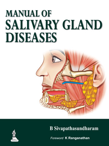 manual-of-salivary-gland-diseases