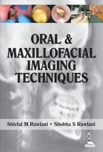 oral-maxillofacial-imaging-techniques