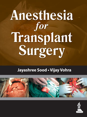 anesthesia-for-transplant-surgery