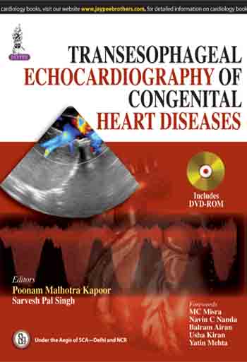 transesophageal-echocardiography-of-congenital-heart-diseases