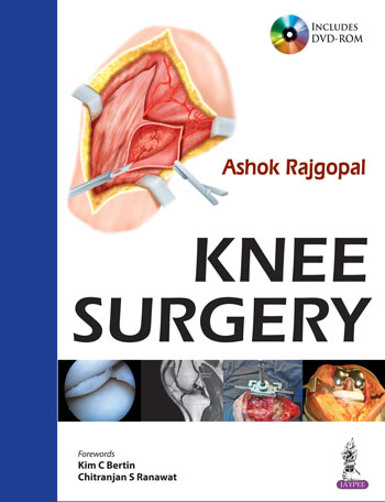 knee-surgery-includes-dvd-rom